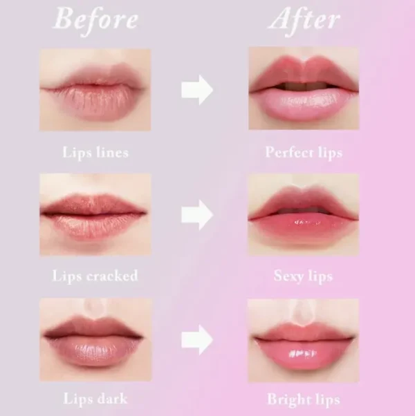 3 Honey Lip Balm Set: Strawberry