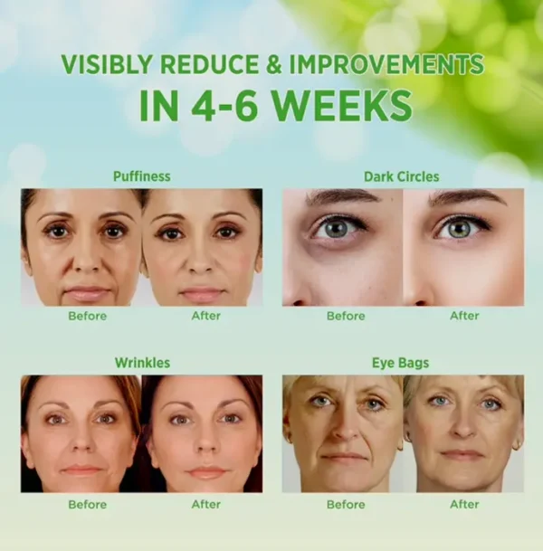VELAMO ADVANCED Retinol Eye Patches for Wrinkles