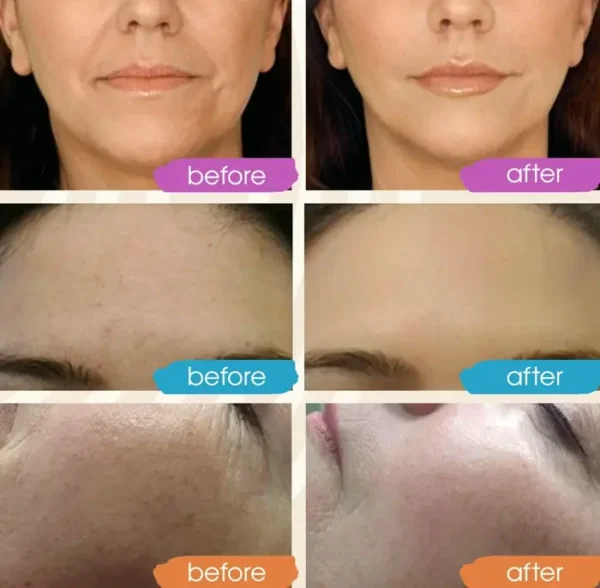 Retinol Face Serum for Hyaluronic Acid (Pack)