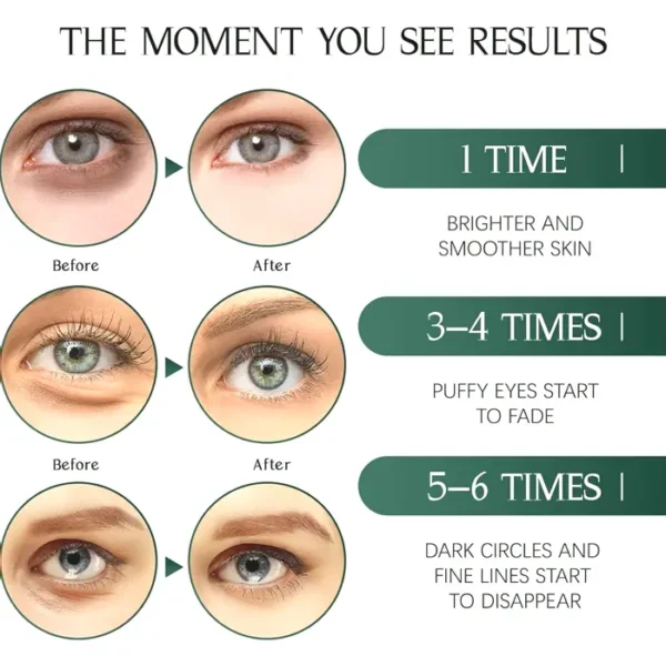 Tiepetly Under Eye Masks, Green Tea Infused