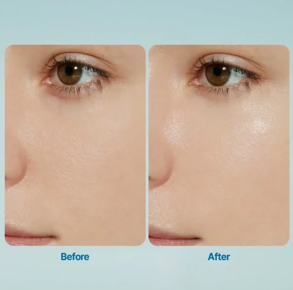 Hyaluronic Acid Moist Sun Gel 50 mL + Free Hyaluronic Acid Moisture Sunscreen 10 mL