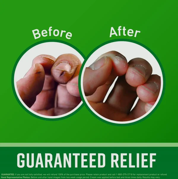 O'Keefe's Working Hands Cream, Extremely Dry Hands, 3.4 Oz Pack