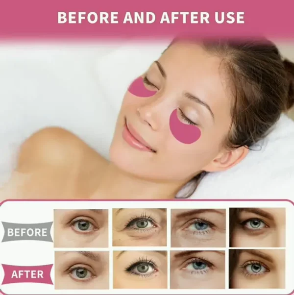 Eye Masks for Puffy Eyes and Bags