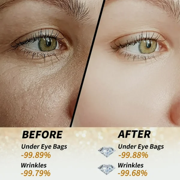 Radiant Glow Undereye Pads - 60pcs Treatment to Reduce Puffy Eyes