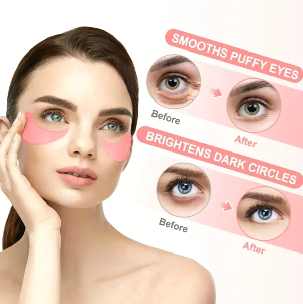 Rose Concealer Patches Set - Dark Circles Care