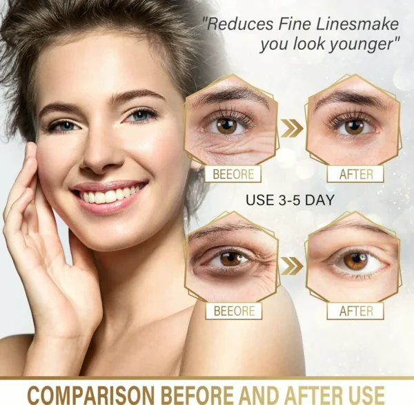 Gold Under Eye Mask for Dark Circles