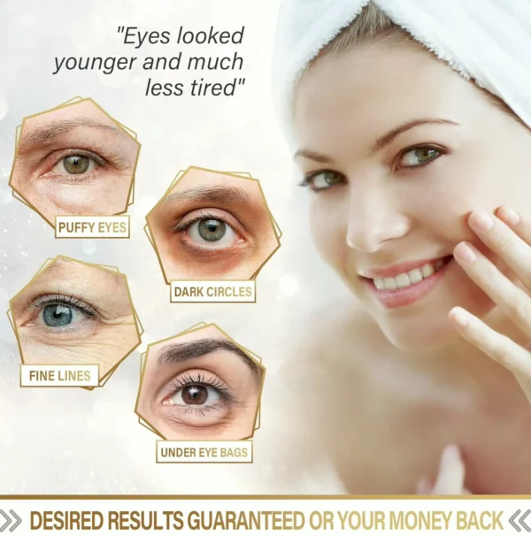 Gold Under Eye Mask for Dark Circles