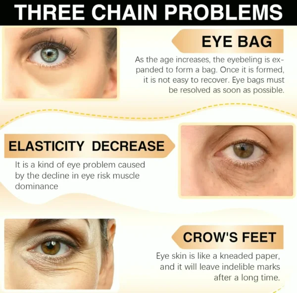 Eye Treatment Stick, Reduce Puffiness & Dark Circles, Blur Fine Lines