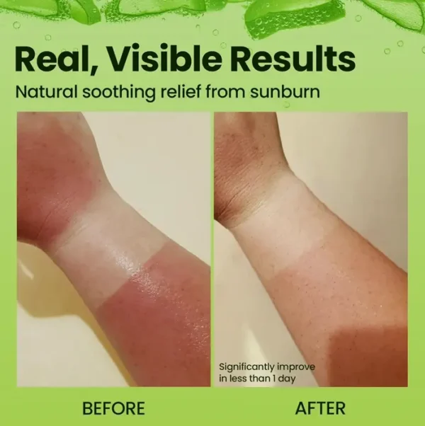 Natural Aloe Gel by Honeyskin - Moisture & Sunburn Care