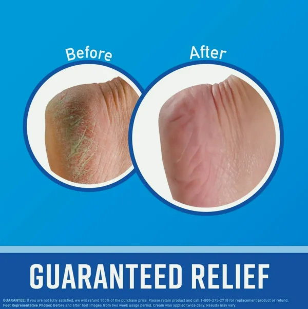 O'Keeffe's Hand and Foot Cream Set, 3-Ounce Tube