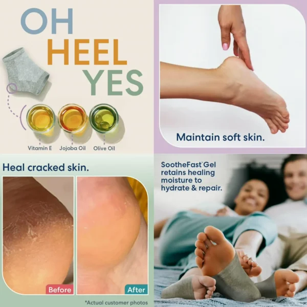 Hydrating Heel Socks for Dry Heels - 2 Pairs